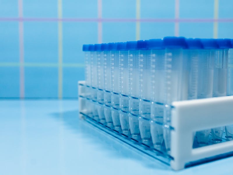 Hemograma completa: test simplu cu informatii esentiale despre sanatate