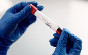 analize sange pentru cancer