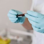 analize pentru articulatii