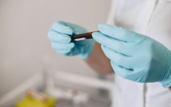 analize pentru articulatii