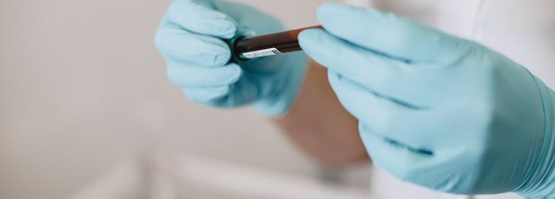 analize pentru articulatii